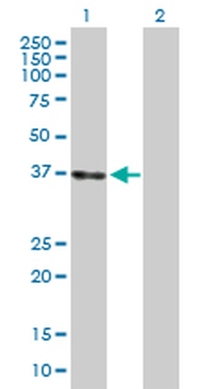 LZTFL1 Antibody in Western Blot (WB)