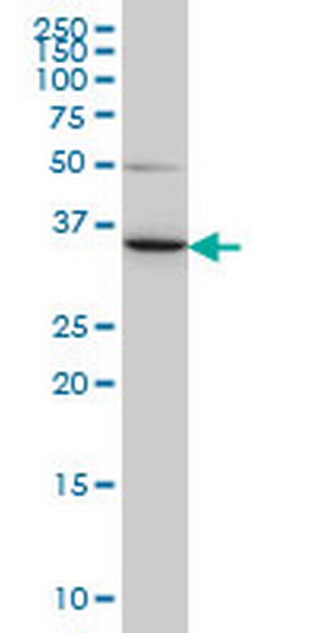 LZTFL1 Antibody in Western Blot (WB)