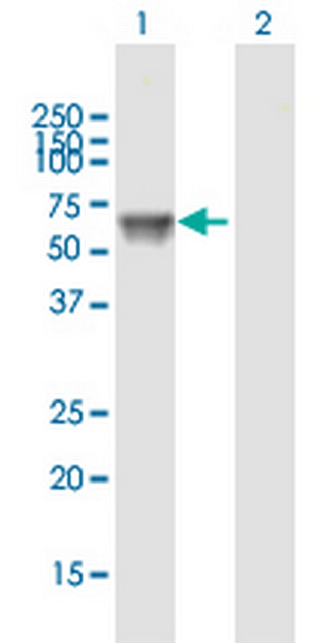 UGT1A9 Antibody in Western Blot (WB)