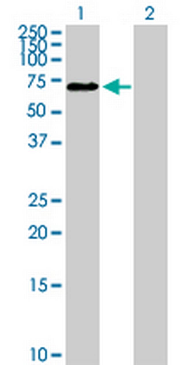 C1orf181 Antibody in Western Blot (WB)