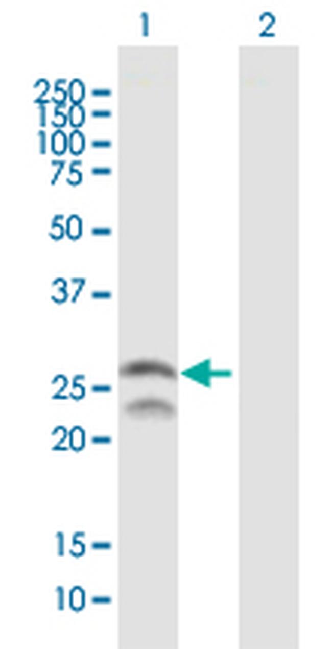 FEV Antibody in Western Blot (WB)