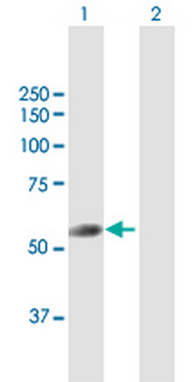 TRIT1 Antibody in Western Blot (WB)