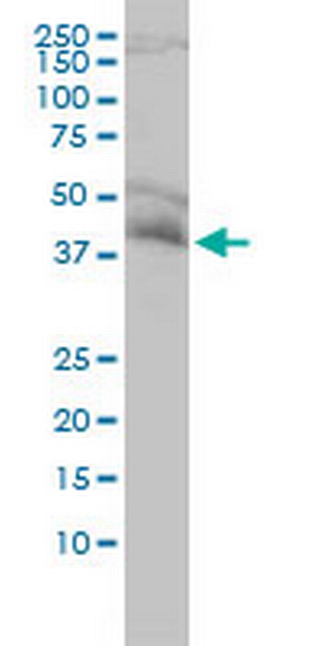 NDE1 Antibody in Western Blot (WB)