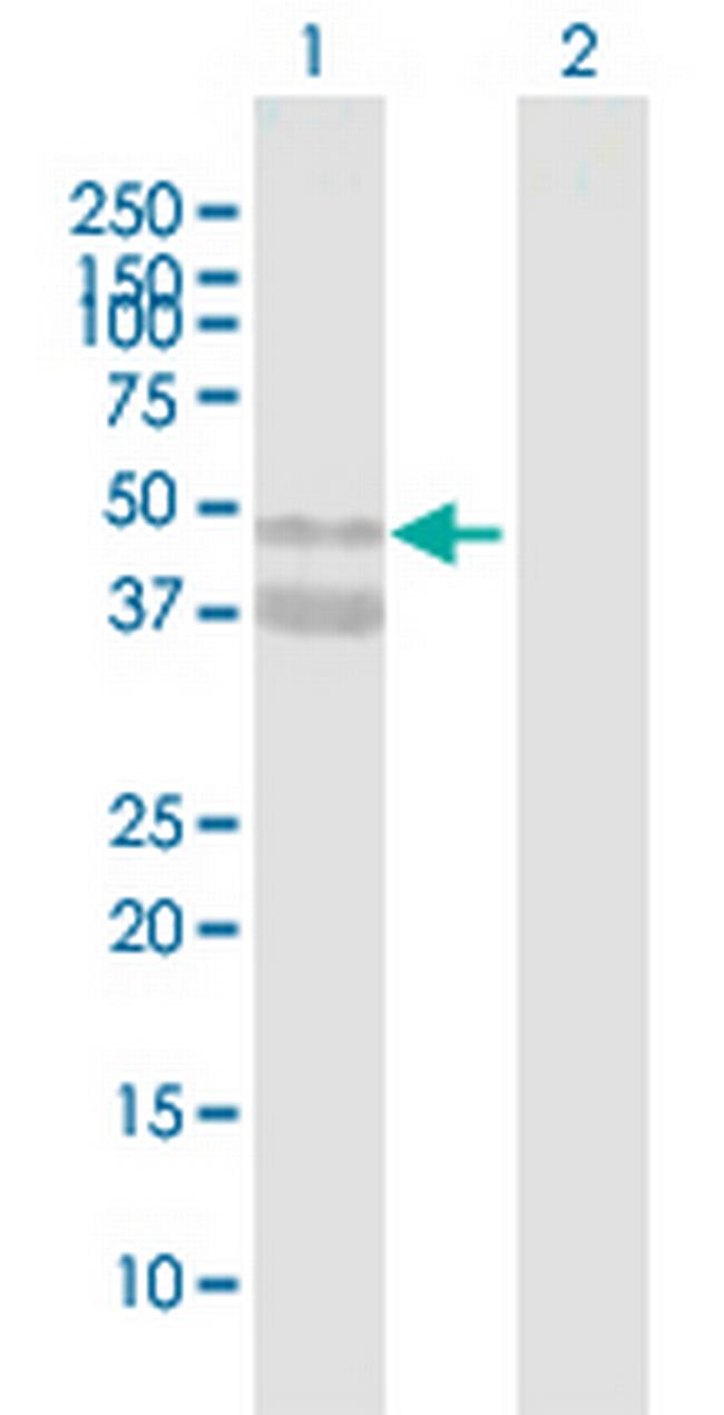 ASPN Antibody in Western Blot (WB)