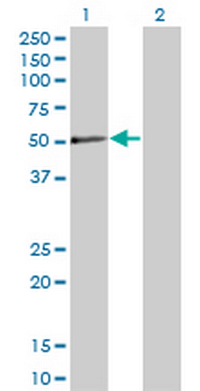 PXK Antibody in Western Blot (WB)