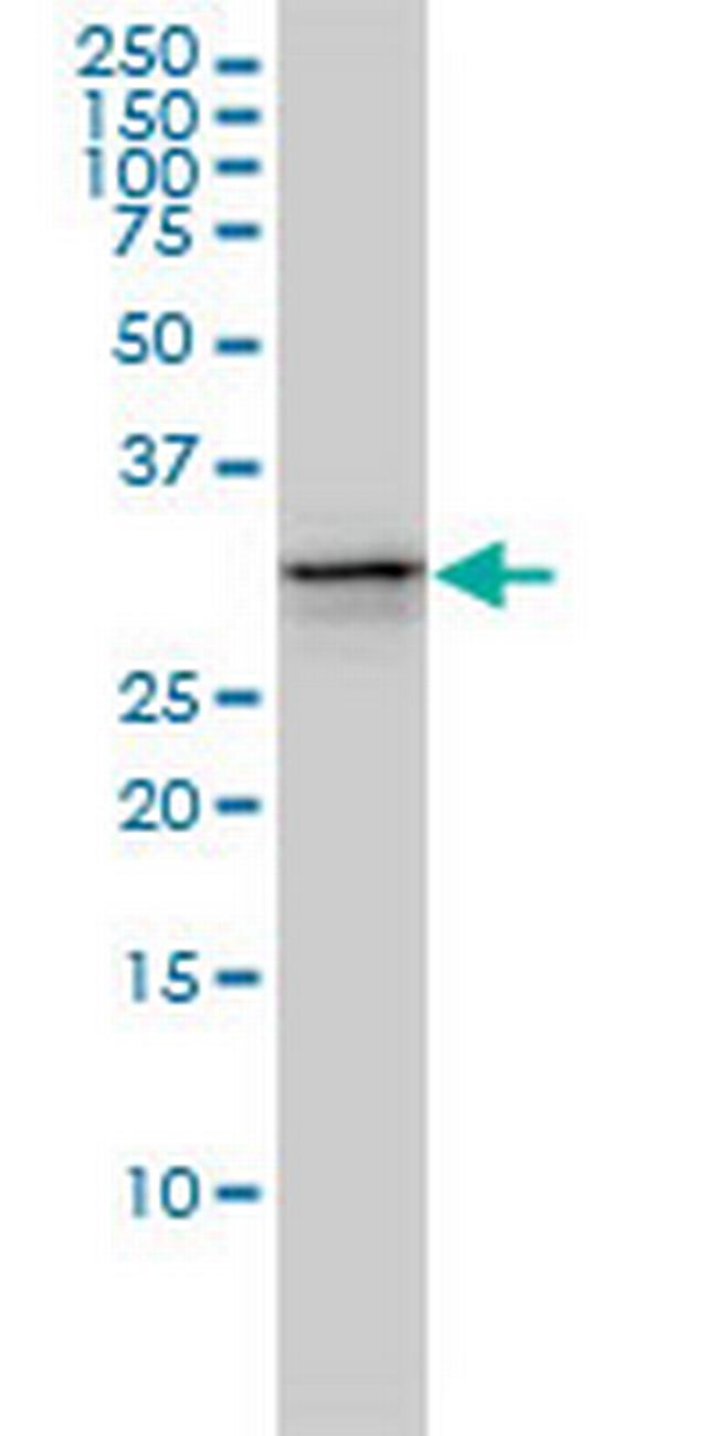 UBE2R2 Antibody in Western Blot (WB)