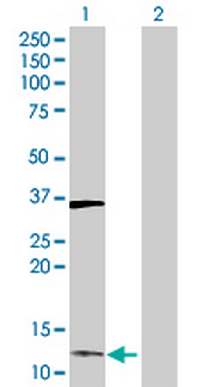 DUSP23 Antibody in Western Blot (WB)