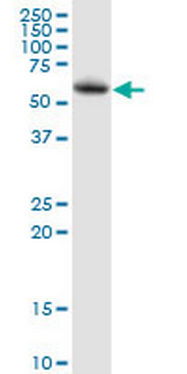 LPCAT2 Antibody in Western Blot (WB)