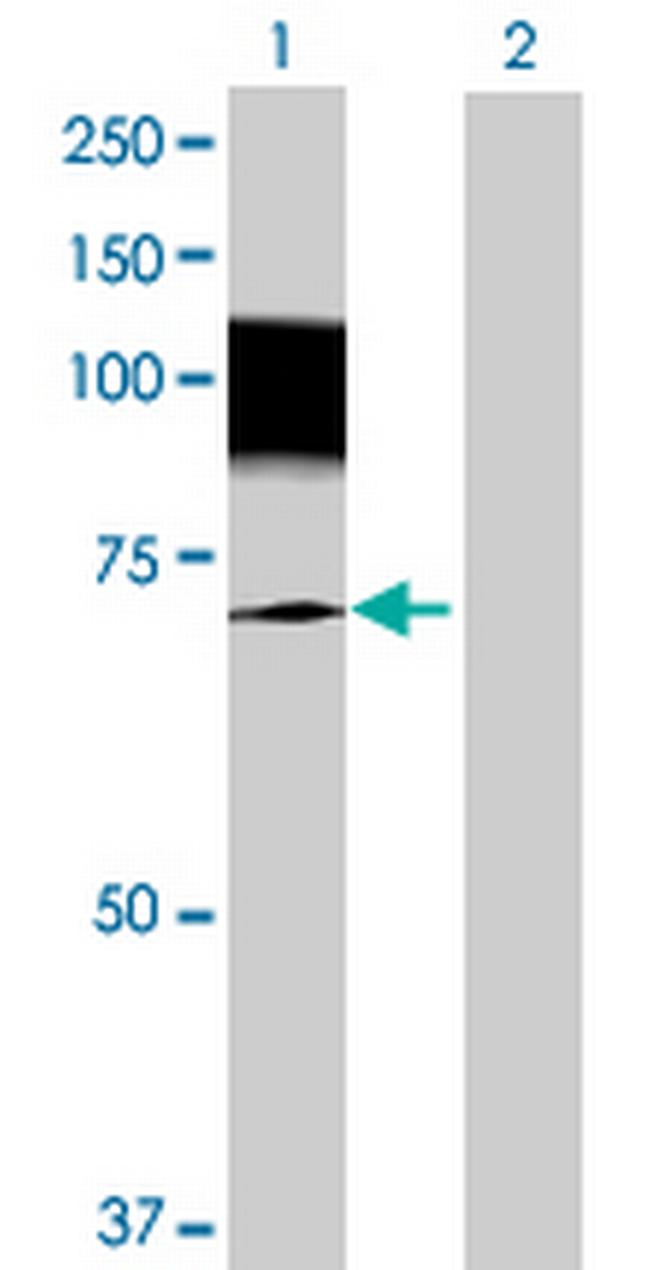 SSH3 Antibody in Western Blot (WB)