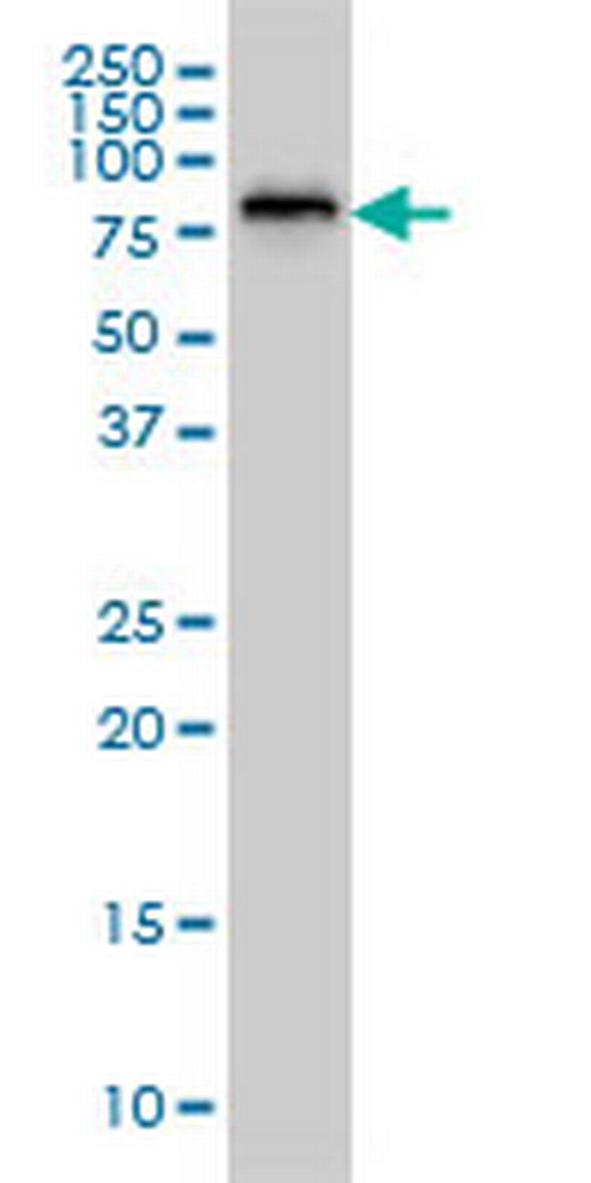 SSH3 Antibody in Western Blot (WB)