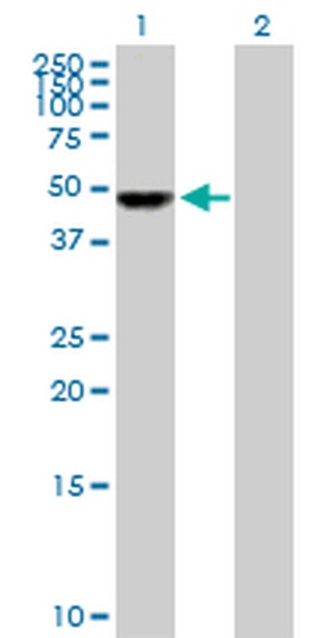 UCKL1 Antibody in Western Blot (WB)