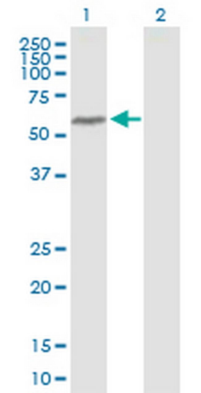 BANP Antibody in Western Blot (WB)