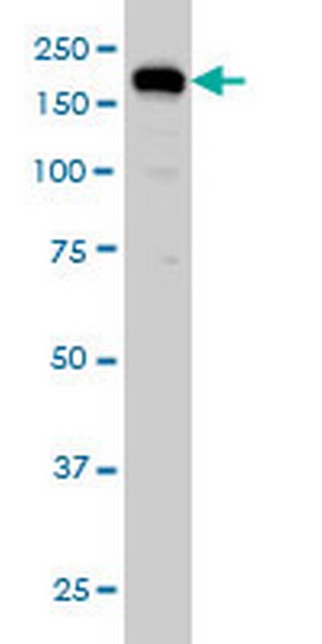 USP47 Antibody in Western Blot (WB)