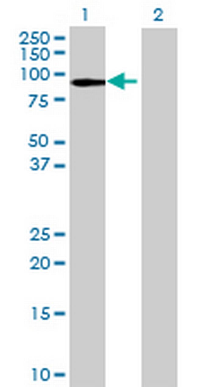 CCDC40 Antibody in Western Blot (WB)