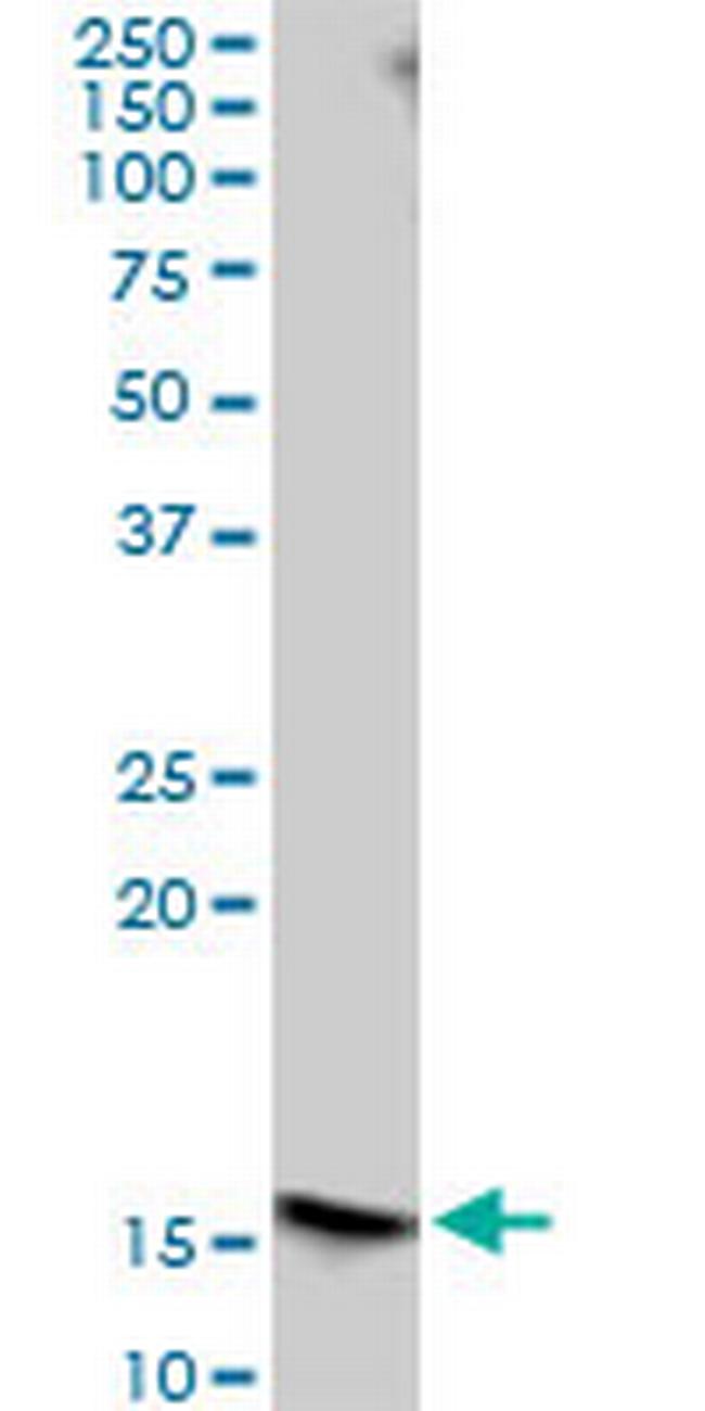 FLJ10292 Antibody in Western Blot (WB)