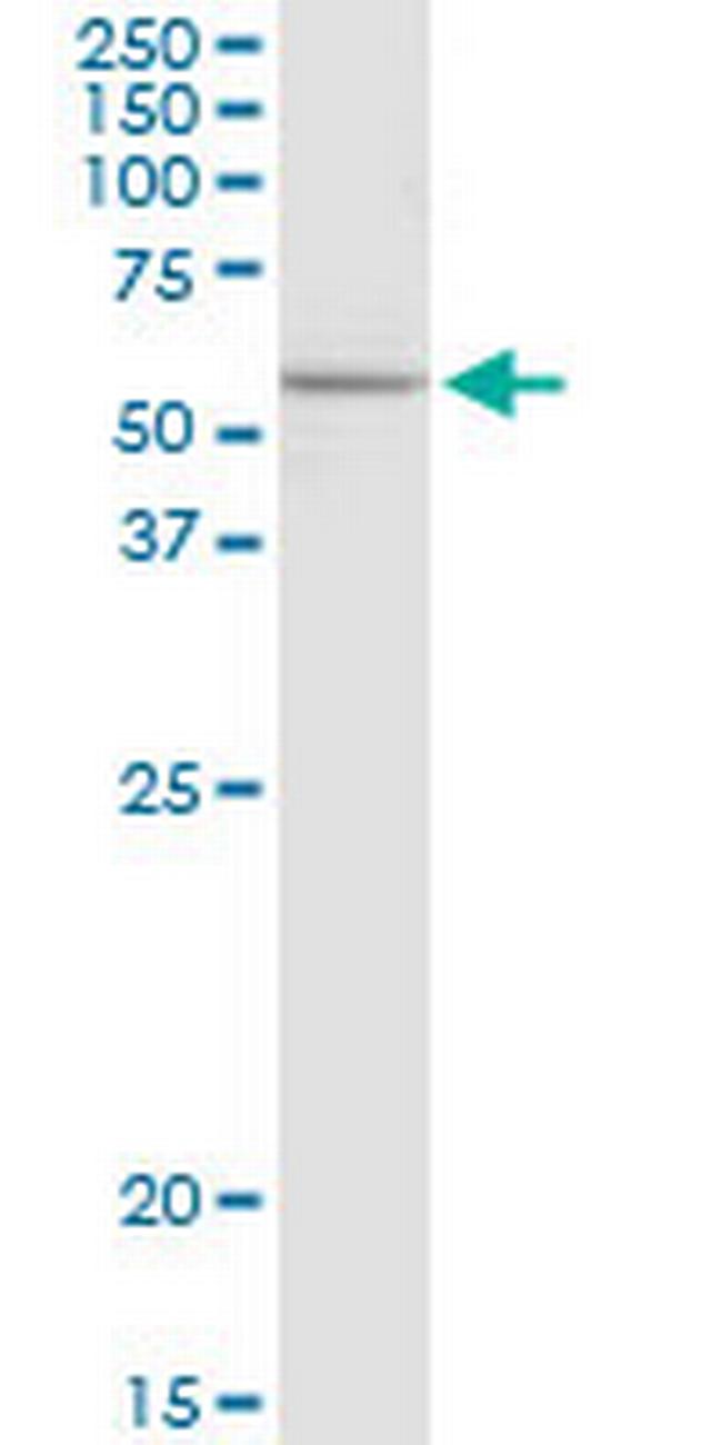 ELP3 Antibody in Western Blot (WB)