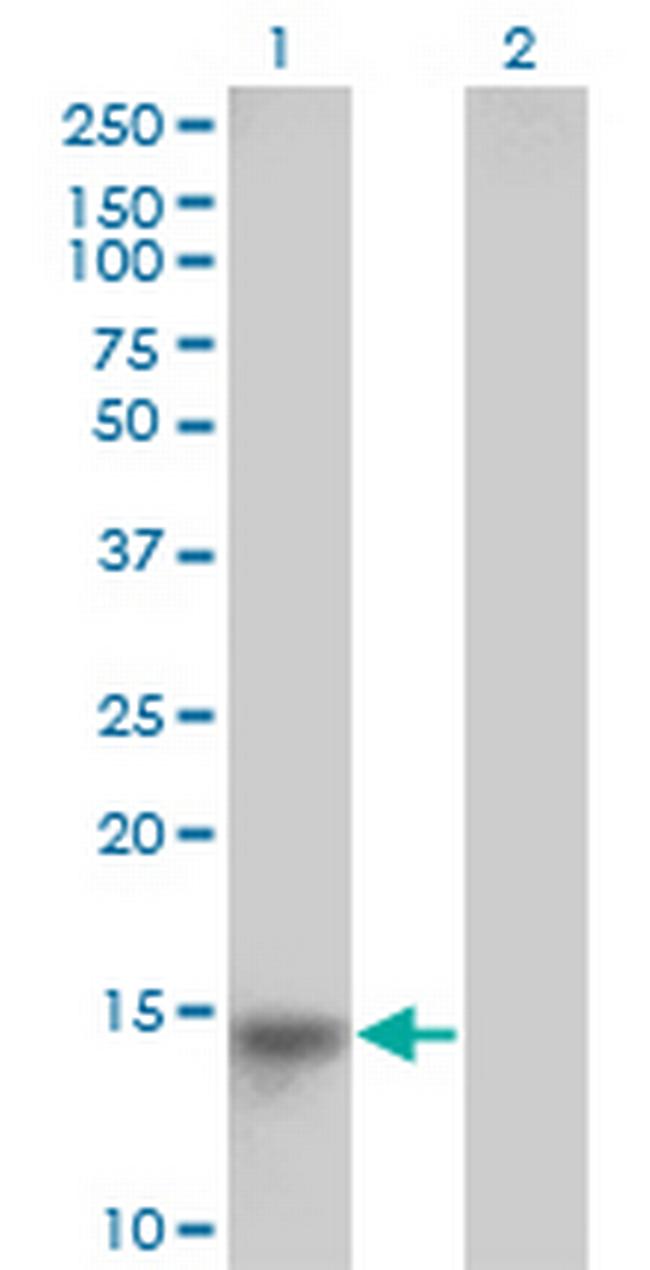 LRRC5 Antibody in Western Blot (WB)