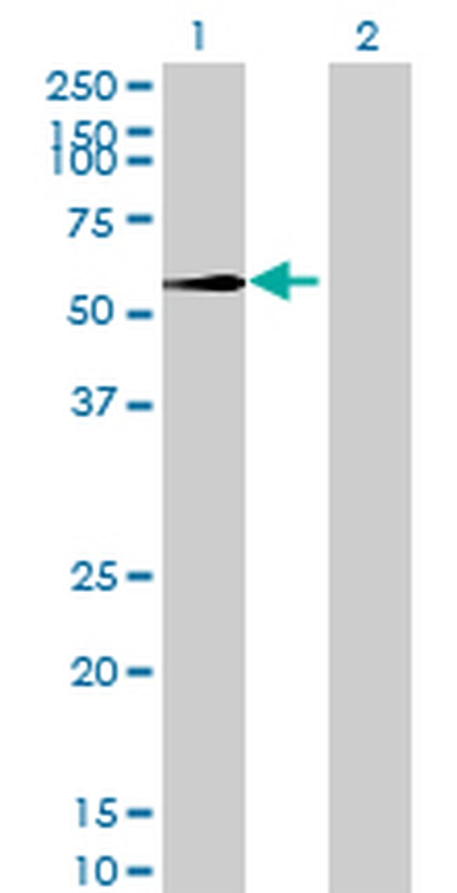 RNMTL1 Antibody in Western Blot (WB)