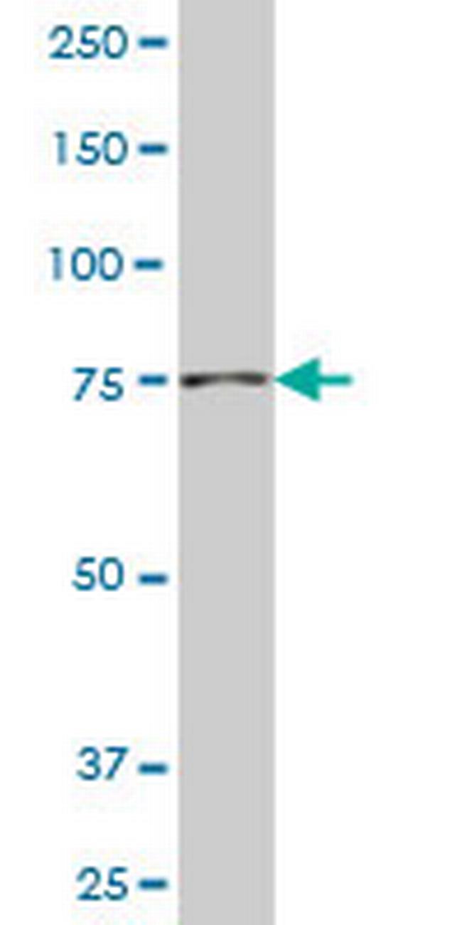 NADSYN1 Antibody in Western Blot (WB)