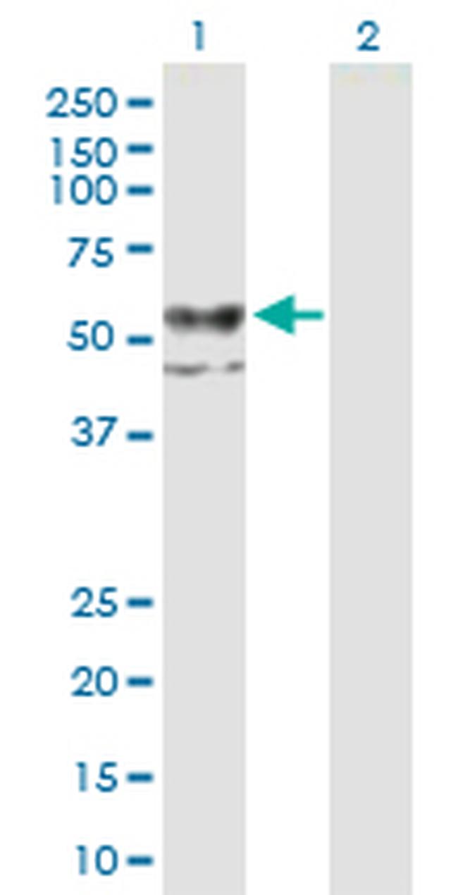 CHST12 Antibody in Western Blot (WB)