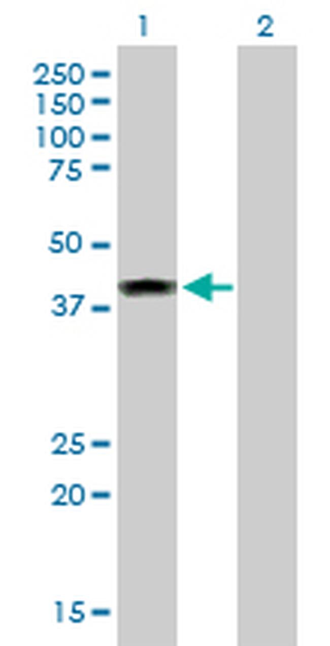 ELAC1 Antibody in Western Blot (WB)