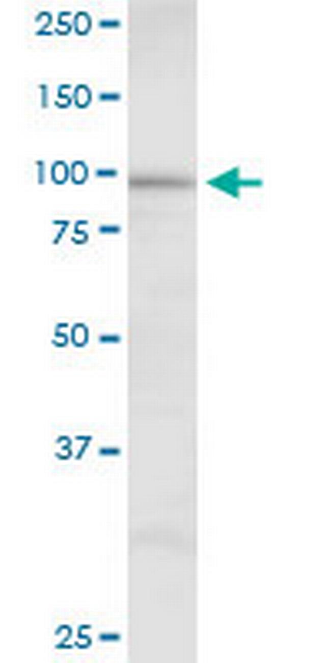 DHTKD1 Antibody in Western Blot (WB)