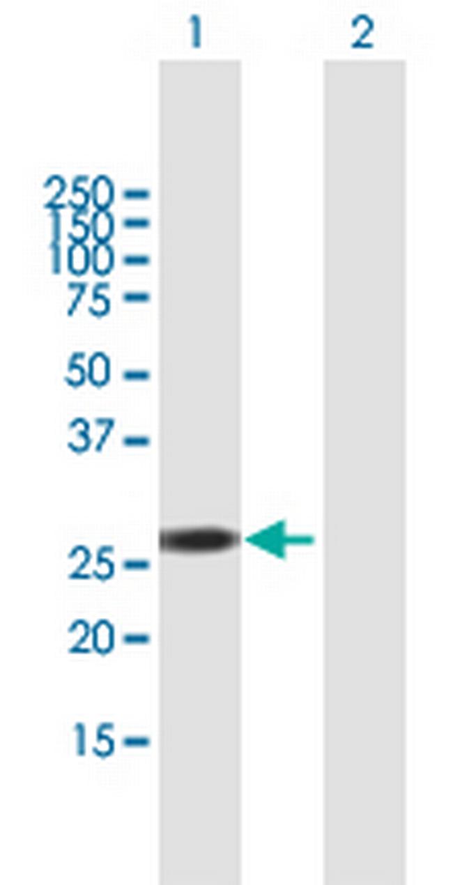 RBM38 Antibody in Western Blot (WB)