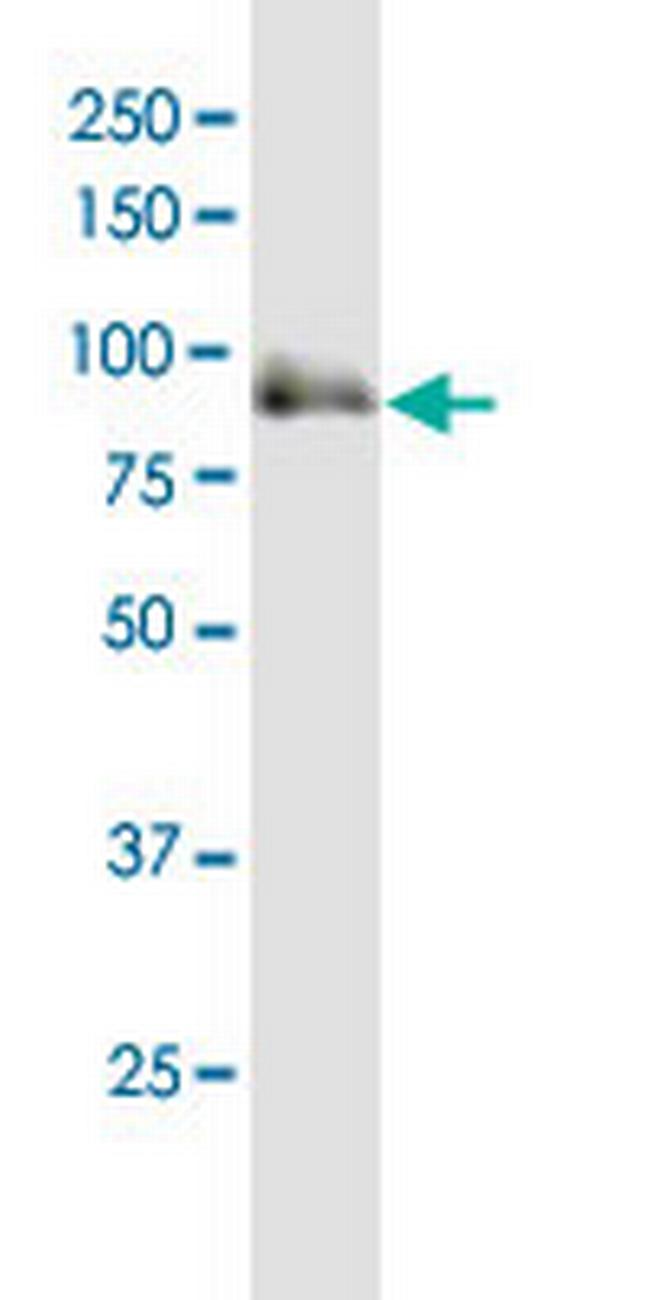 SOX6 Antibody in Western Blot (WB)