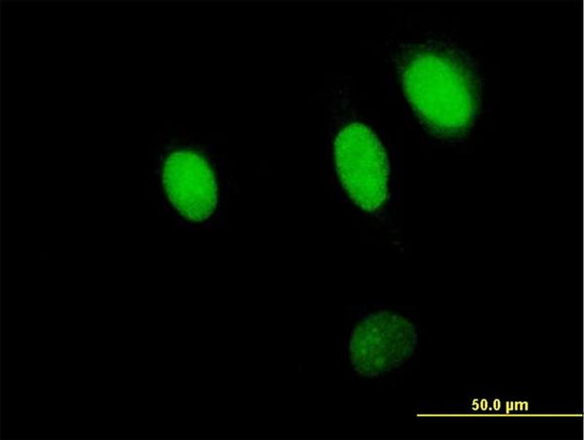 NPLOC4 Antibody in Immunocytochemistry (ICC/IF)