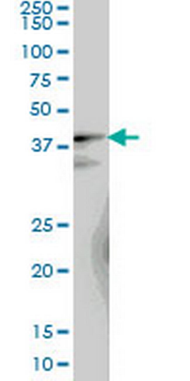 LUC7L Antibody in Western Blot (WB)