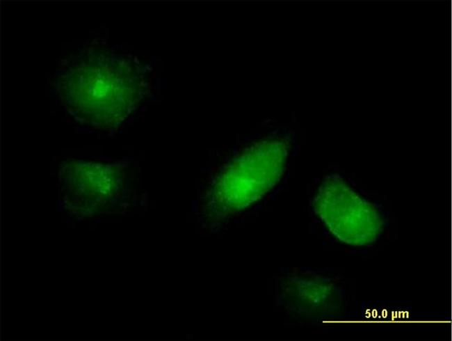 VAC14 Antibody in Immunocytochemistry (ICC/IF)