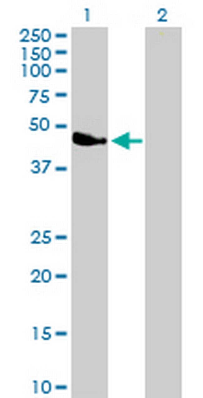 PARVA Antibody in Western Blot (WB)