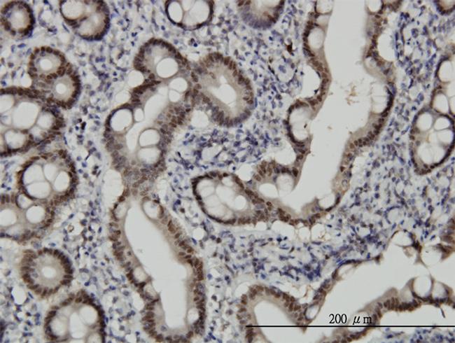 CHFR Antibody in Immunohistochemistry (Paraffin) (IHC (P))