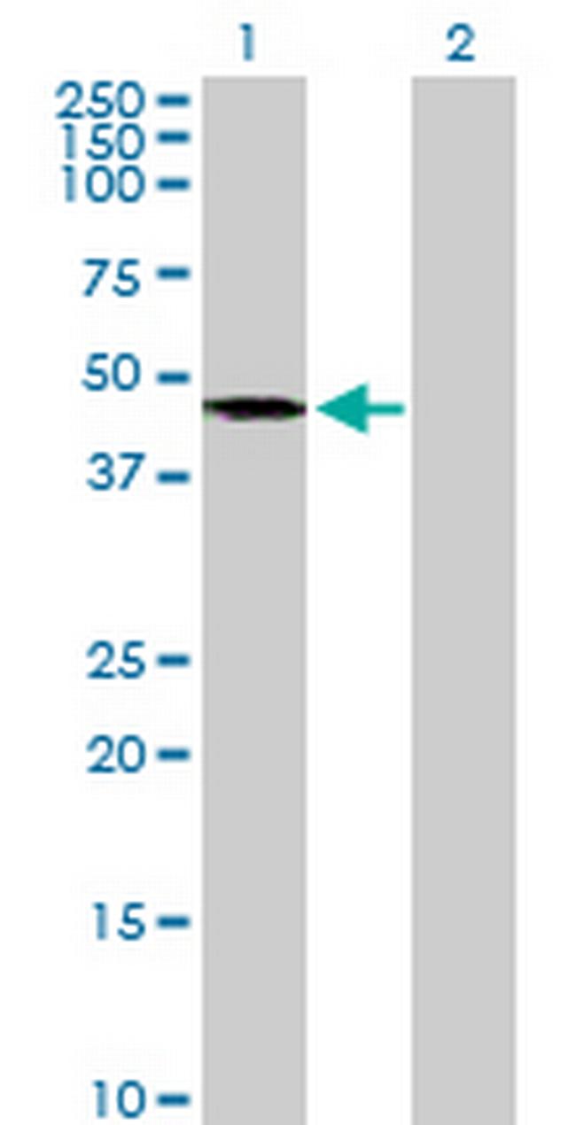 AGK Antibody in Western Blot (WB)