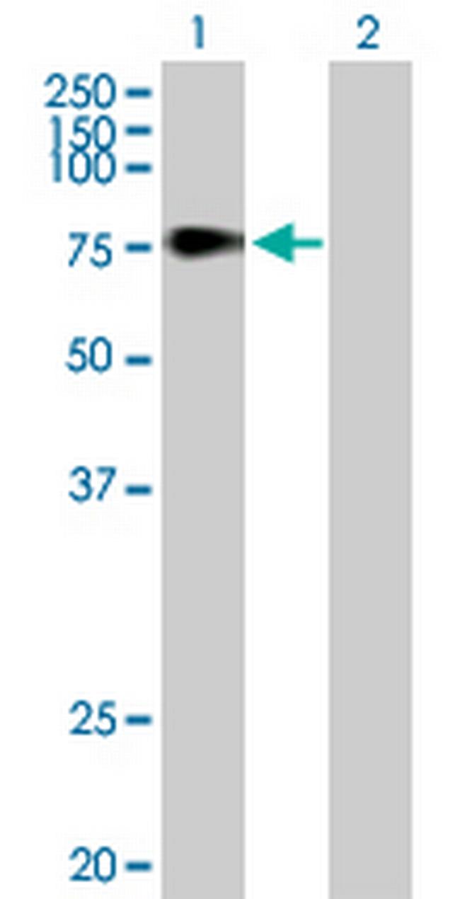 TDP1 Antibody in Western Blot (WB)