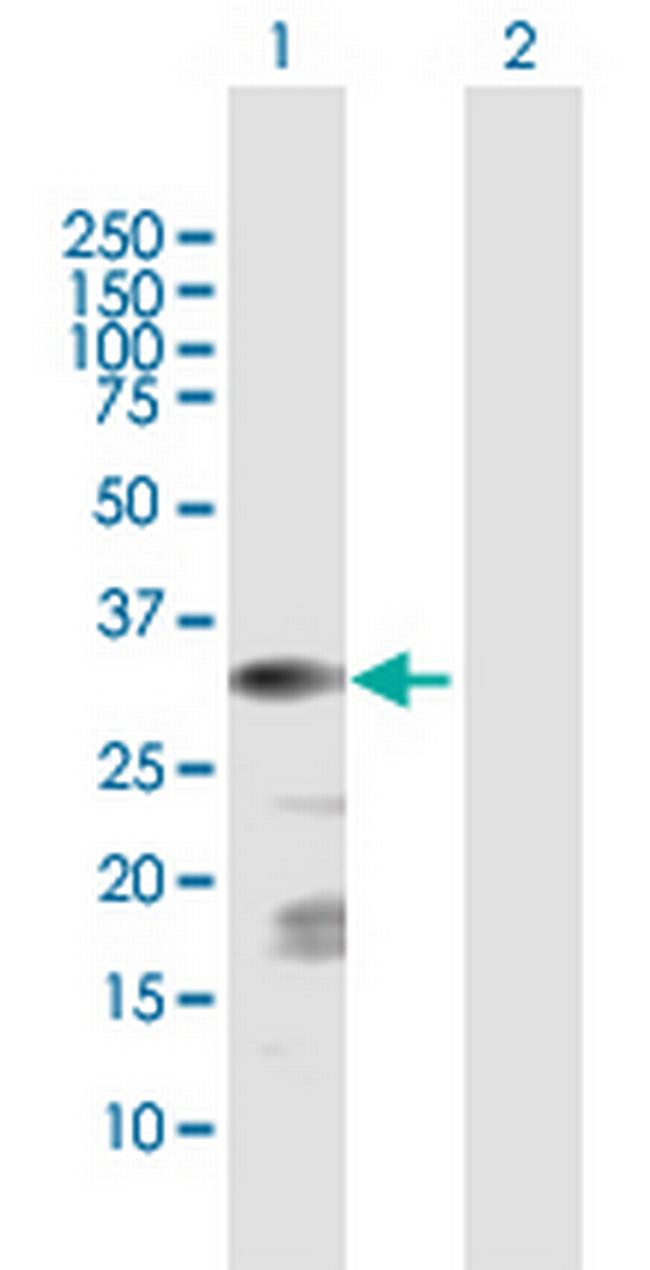 CSGALNACT1 Antibody in Western Blot (WB)