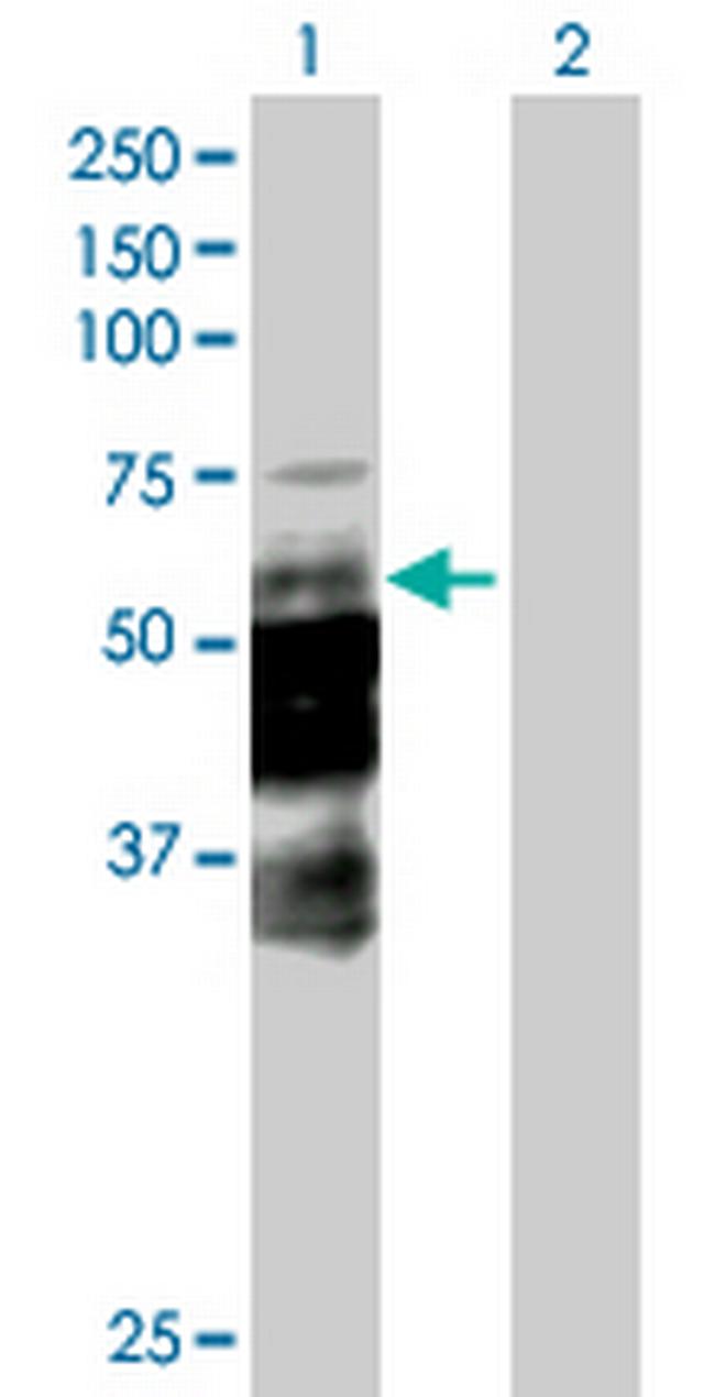 DCP1A Antibody in Western Blot (WB)