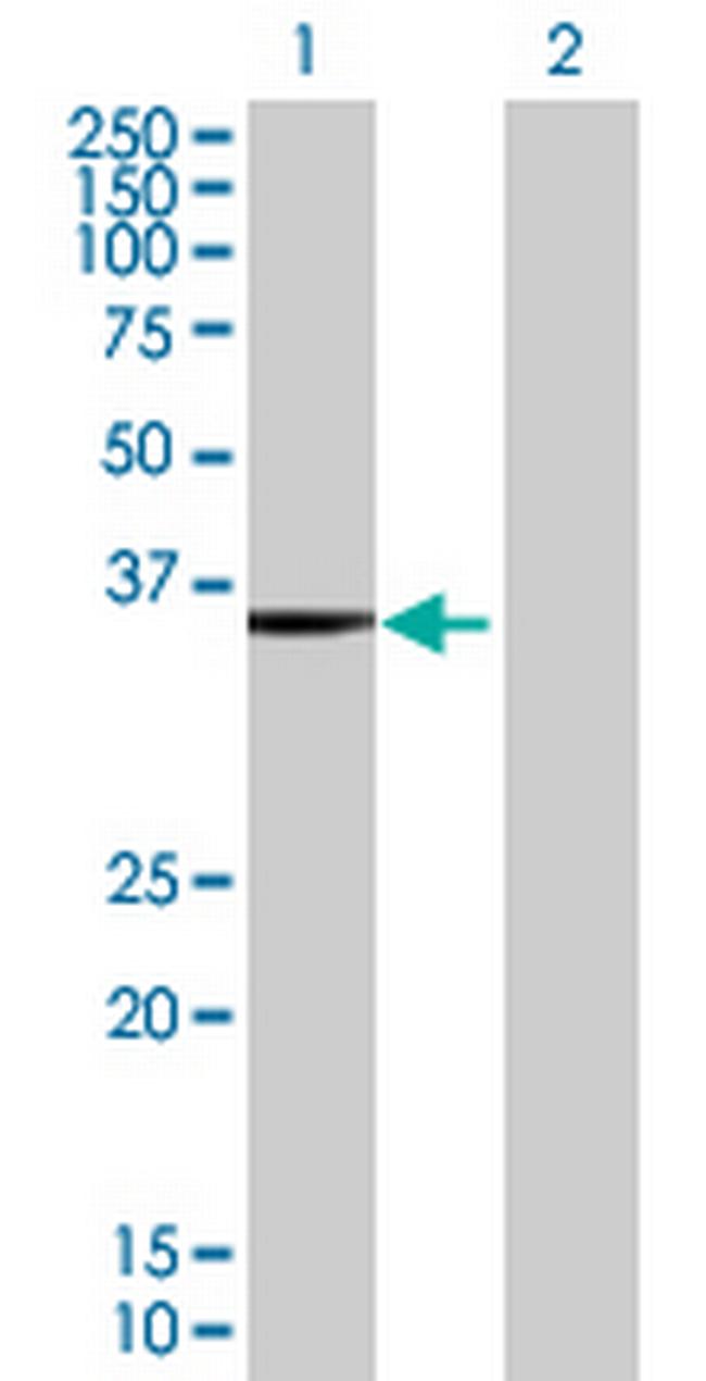 VPS11 Antibody in Western Blot (WB)