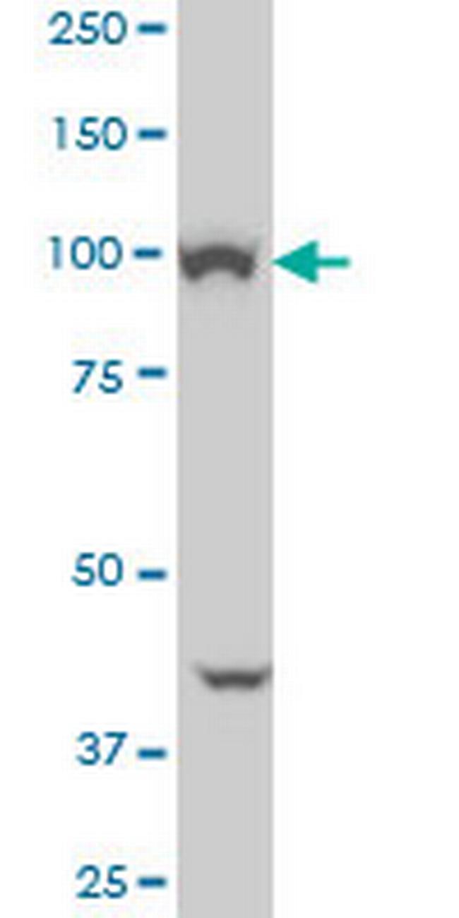 VPS11 Antibody in Western Blot (WB)