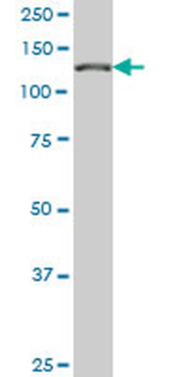 CAND1 Antibody in Western Blot (WB)