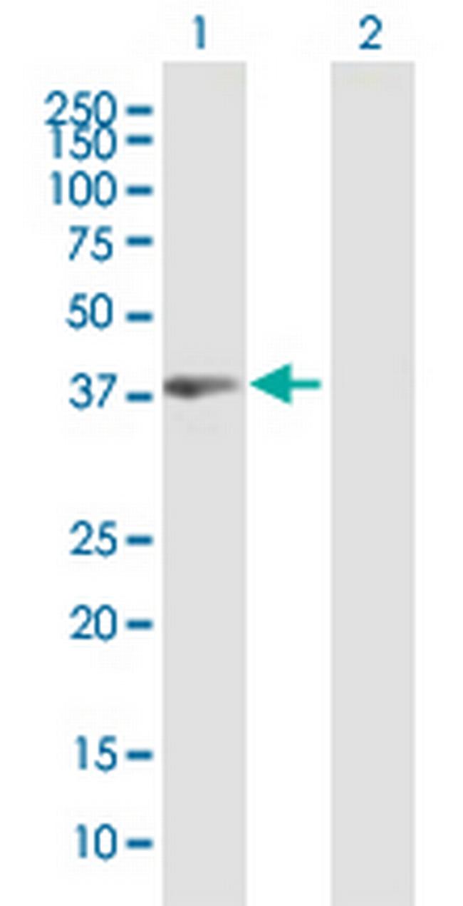 PBK Antibody in Western Blot (WB)