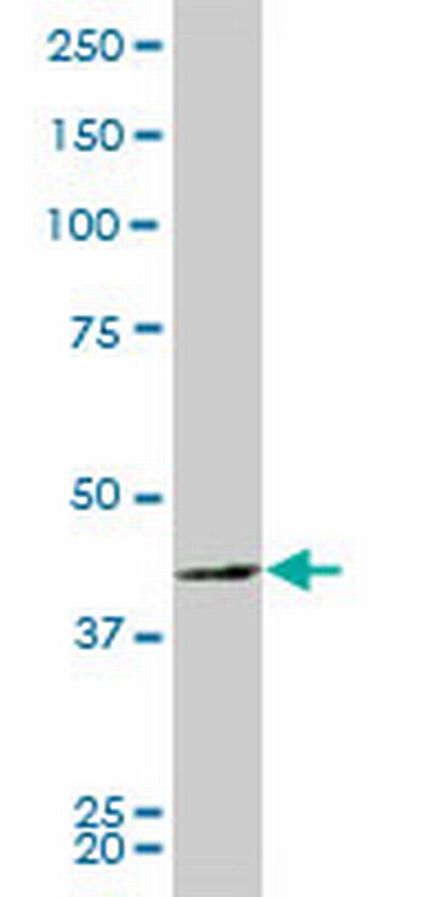 PBK Antibody in Western Blot (WB)