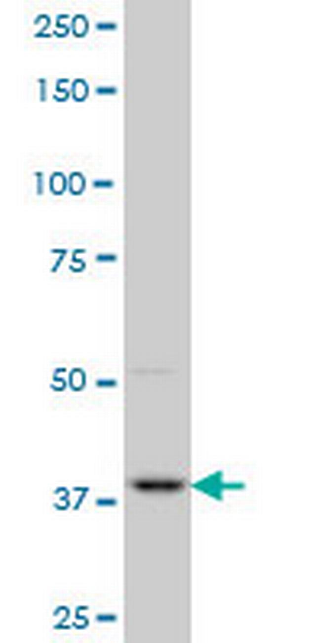 PBK Antibody in Western Blot (WB)