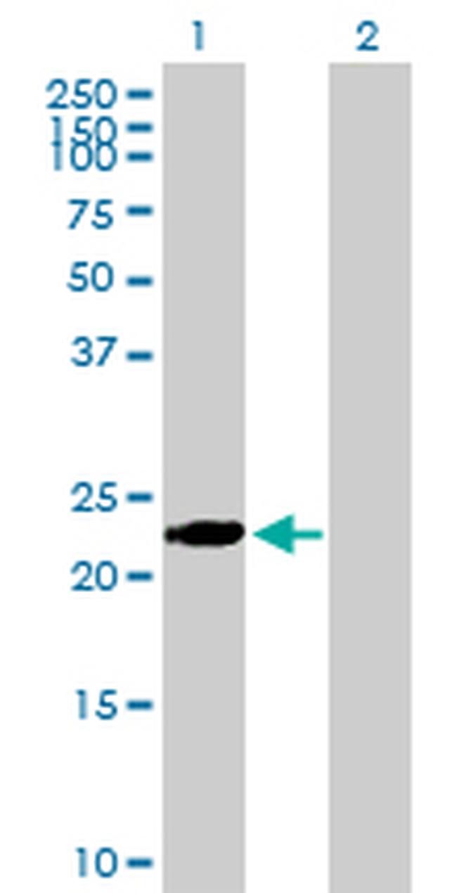 BIN3 Antibody in Western Blot (WB)