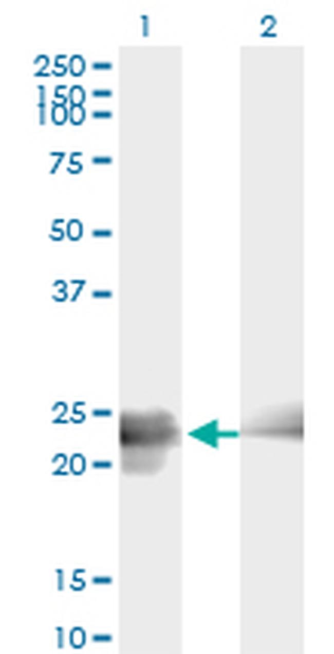 BIN3 Antibody in Western Blot (WB)