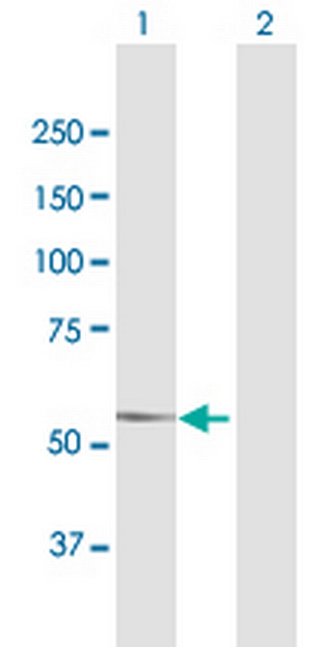 DMAP1 Antibody in Western Blot (WB)