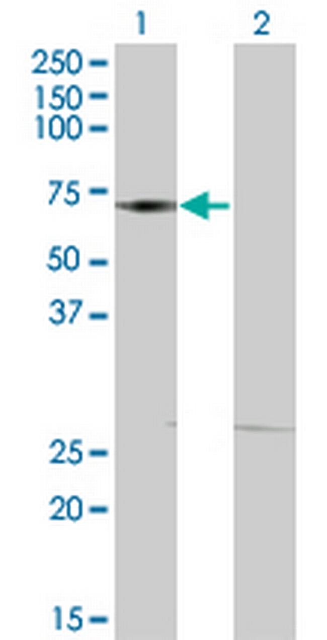 DMAP1 Antibody in Western Blot (WB)