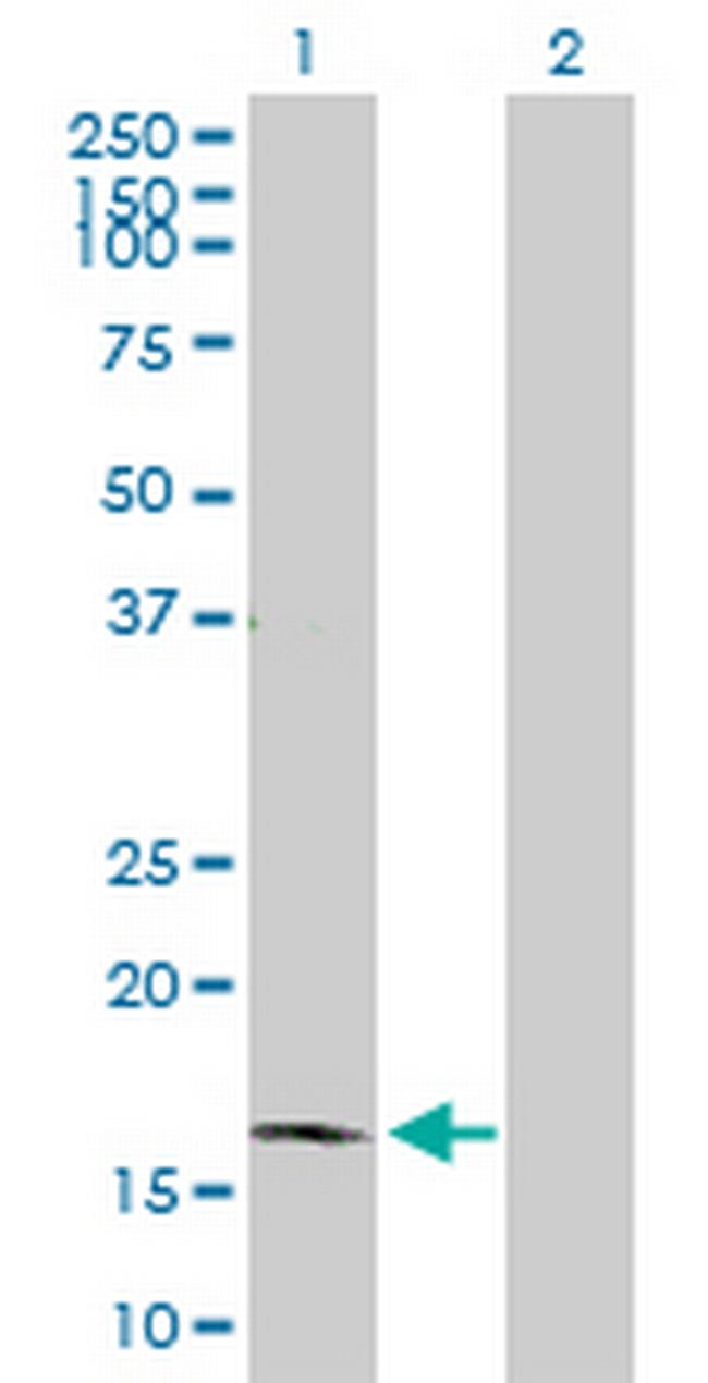 BARX1 Antibody in Western Blot (WB)