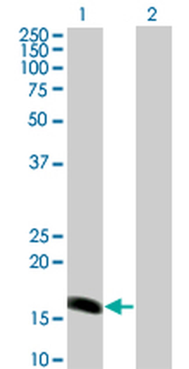 BARX1 Antibody in Western Blot (WB)