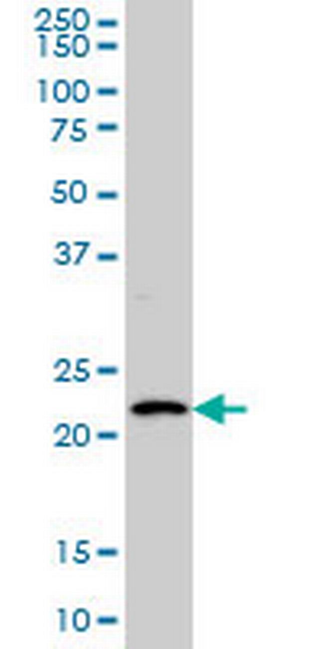 BARX1 Antibody in Western Blot (WB)